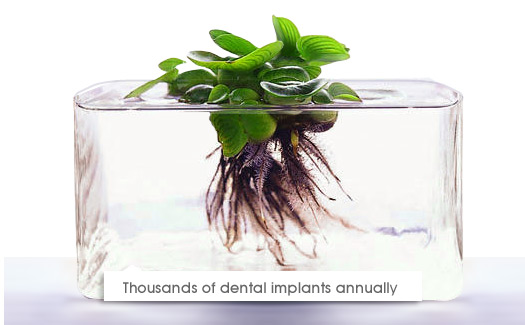 Dental Implants